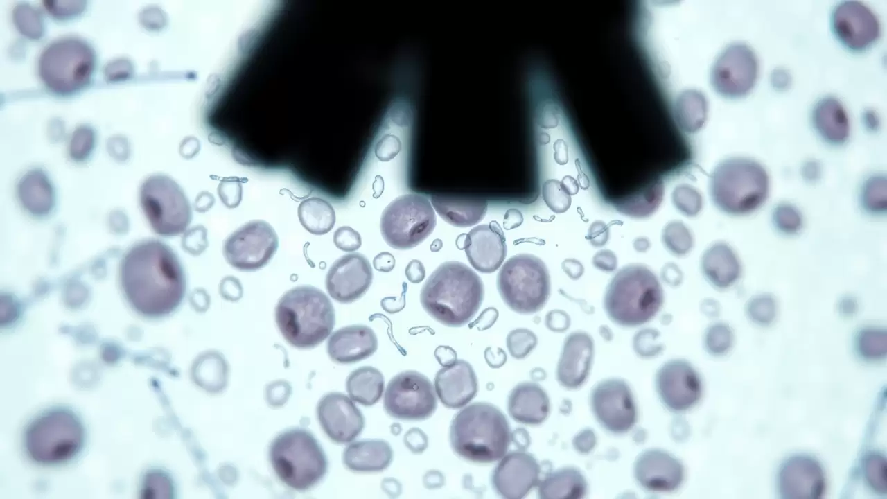 Anticorpi de lamă oferă protecție împotriva variantelor de coronavirus