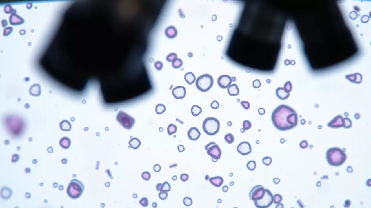 Benzaldehida din migdale combate celulele canceroase rezistente la terapii
