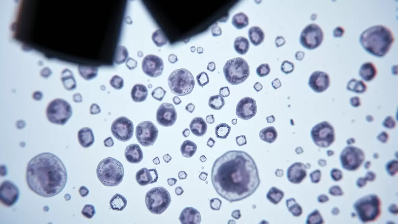 Cercetătorii australieni descoperă o nouă strategie pentru combaterea cancerelor agresive prin blocarea procesului molecular minor splicing