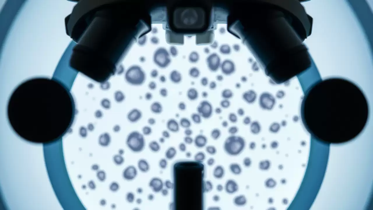 Instrument AI egalează precizia medicilor în conturarea tumorilor pulmonare