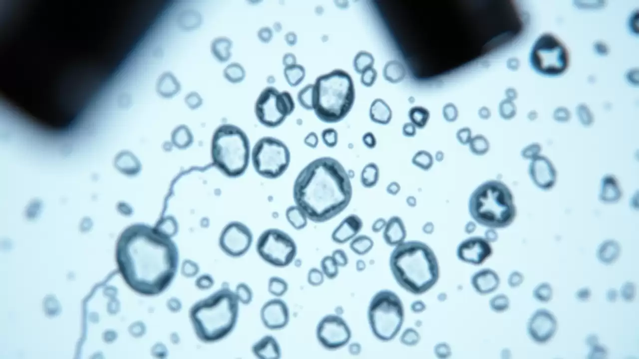 Verapamilul promite preservarea celulelor beta în diabetul tip 1