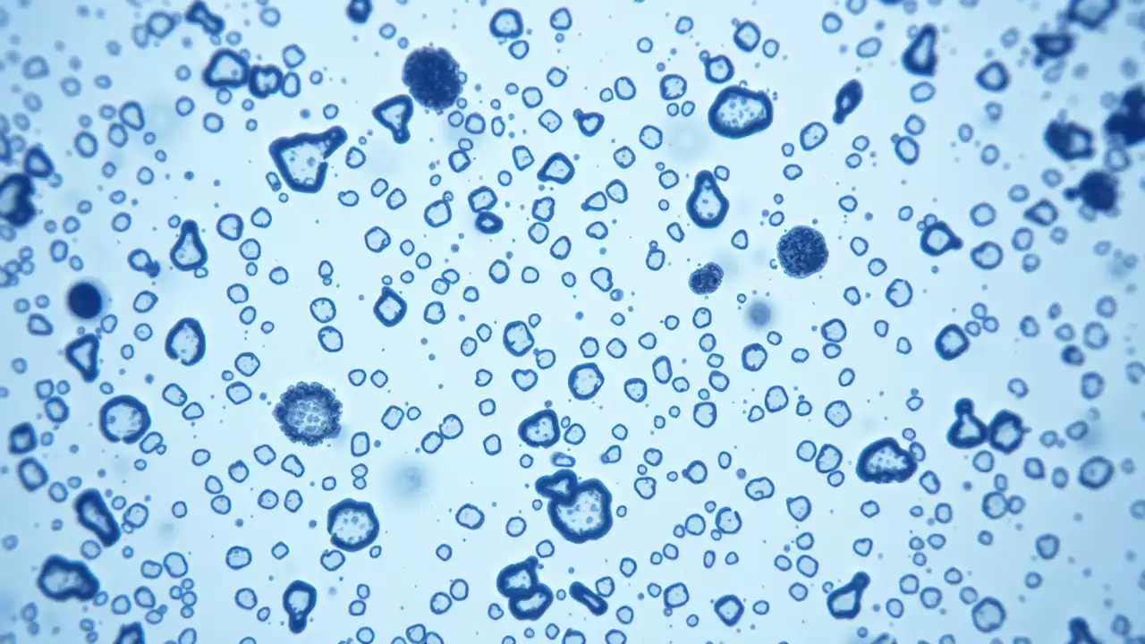 Celule imune din pancreas ar putea preveni diabetul de tip 1