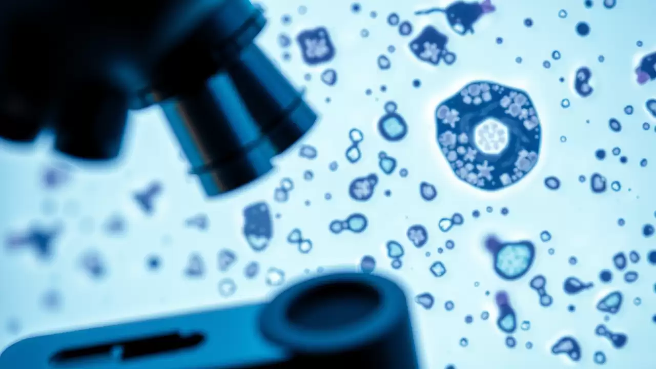 Detectarea cancerului în sânge cu trei ani înainte de diagnostic