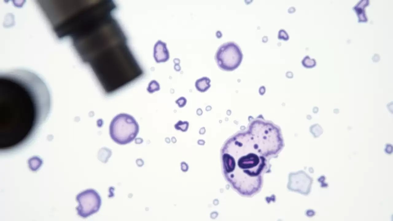 Test de sânge detectează cancerul de cap și gât cu 10 ani înainte de simptome