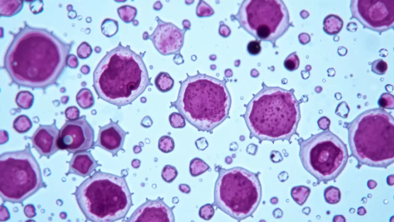 Descoperire revoluționară în tratamentul cancerului de prostată prin blocarea enzimelor protectoare