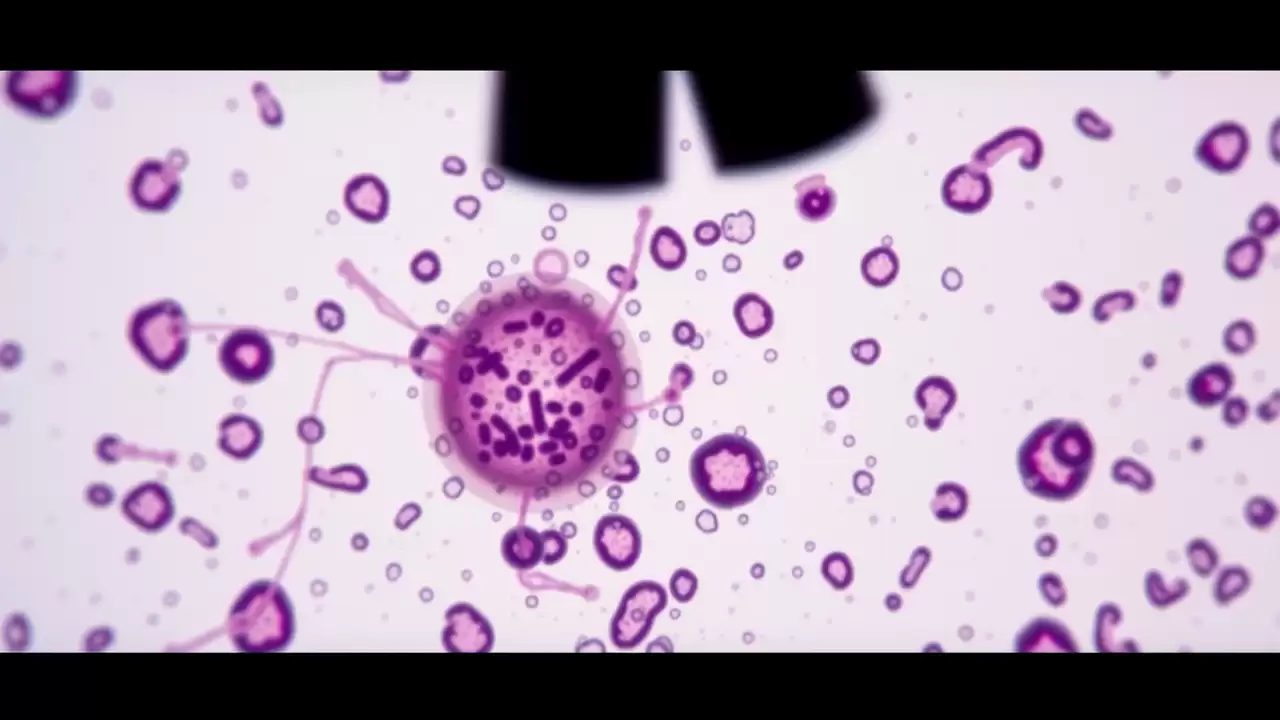 Diabetul matern tip 1 protejează copiii prin modificări epigenetice