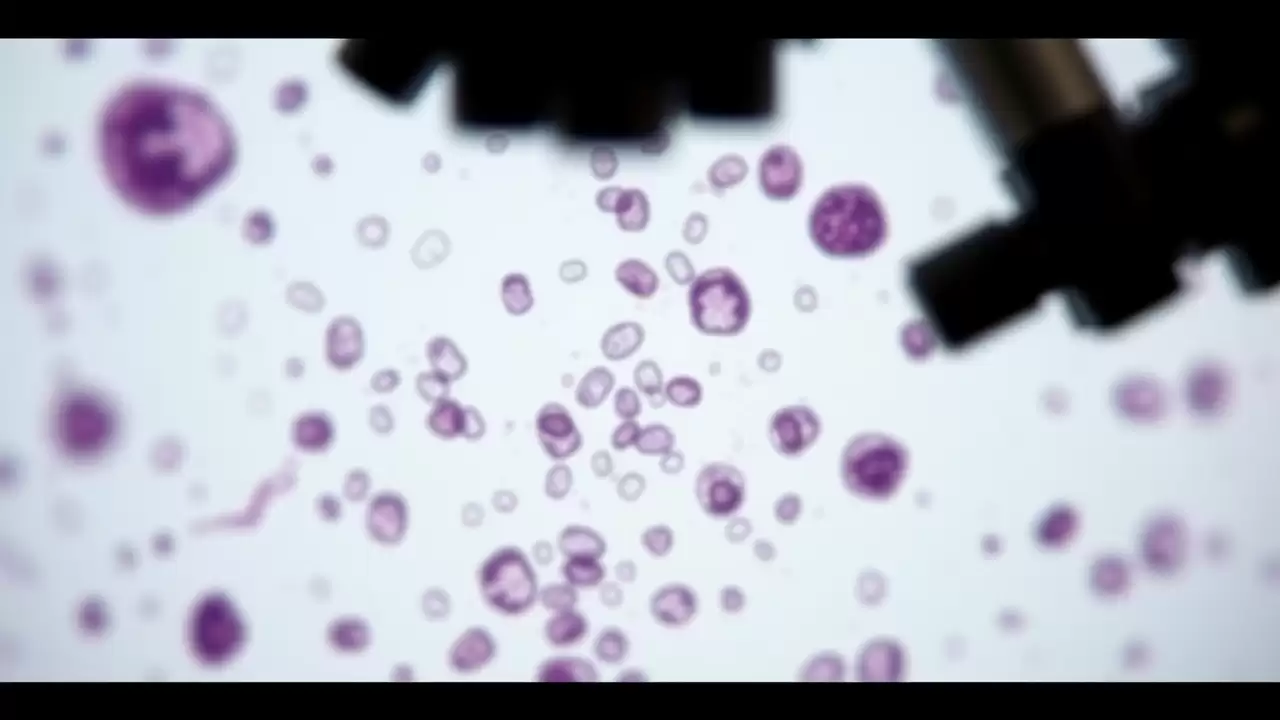 Diabetul crește de până la 6,5 ori riscul de moarte cardiacă subită