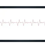 Știre despre cardiac, dispozitiv monitorizare activitate și dispozitive