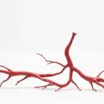 Știre despre accident vascular cerebral, artere și biomarkeri