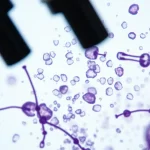 Știre despre antioxidanți, cardiovascular function și consum