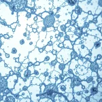 Știre despre alimente, bacterii și bacterii orale